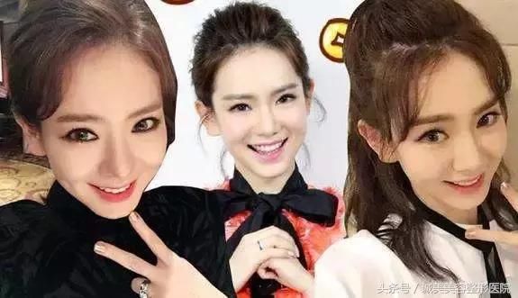 苹果肌和高颧骨之间有超大区别，你分得清楚吗？