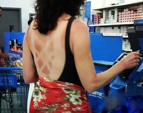 英国100年来最热夏天？别再去晒日光浴了！