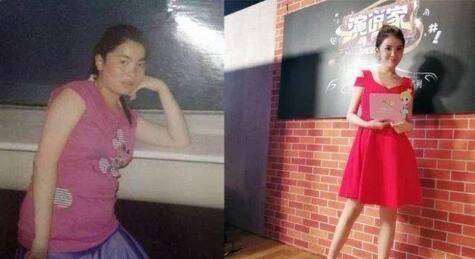 丑女整容多次成美女,追求者无数!称:没好看的容貌就没好的青春