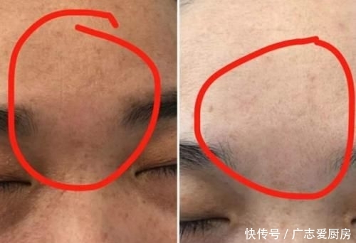  毛孔粗大■女生脸上毛孔大到能插秧？教你3个小窍门，助你皮肤Q弹似果冻