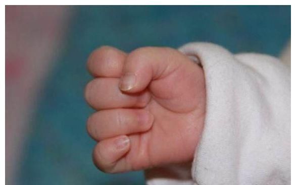  「超出」为什么孩子出世后总一直握着“握拳”？超出这个月，家长还要注意了