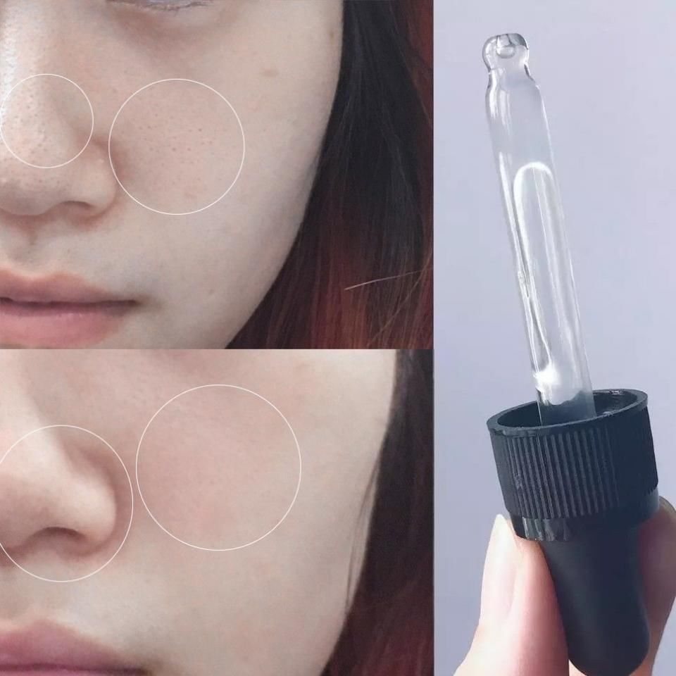 几十块就能收毛孔!这支超好用的“磨皮原液”，连我的黑头也治好