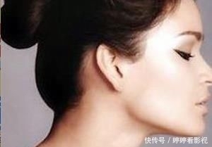  【消肿】自体脂肪丰下巴多久能消肿