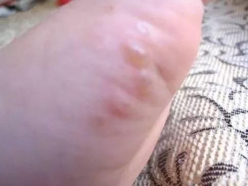 脱下高跟鞋后疲惫的双脚，需要一双这样的日式防滑杀菌拖鞋！