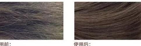 鹿晗、阿娇、张歆艺等明星御用的洗发水，狂销千万瓶的控油固发神