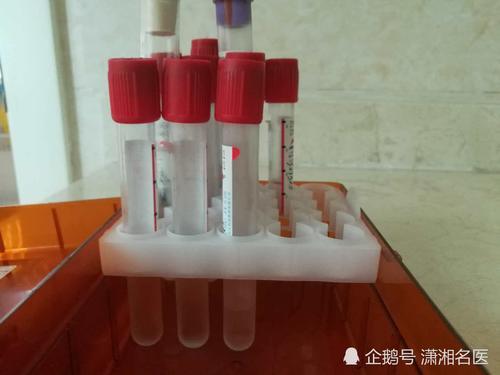 29岁小伙智力突然变幼儿,原来患上自身免疫性