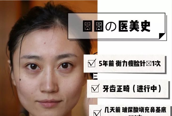 「衰老问题」素人整形分析 | 做对这些,宽方脸比瓜子脸更有优势