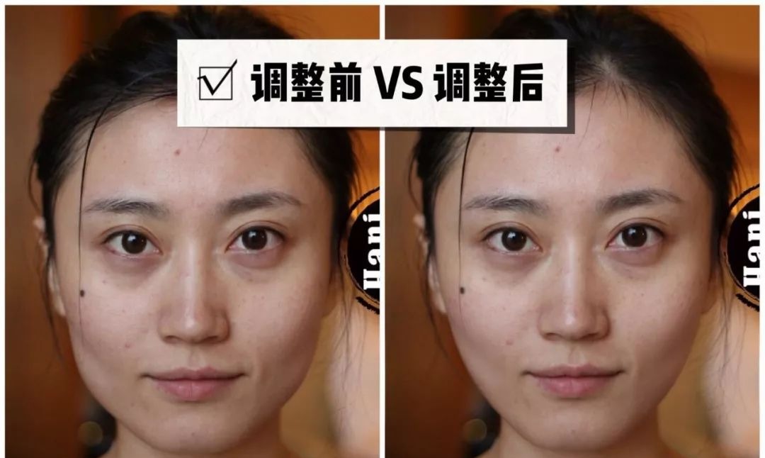 「衰老问题」素人整形分析 | 做对这些,宽方脸比瓜子脸更有优势