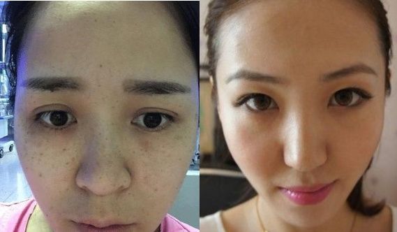 维生素E加一物?不花钱的美白祛斑方法，却让顽固斑点烟消云散!