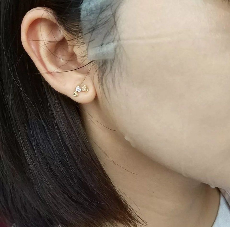 效果逆天的“收毛孔神器”，三周毛孔就变小，都说像去做了医美!