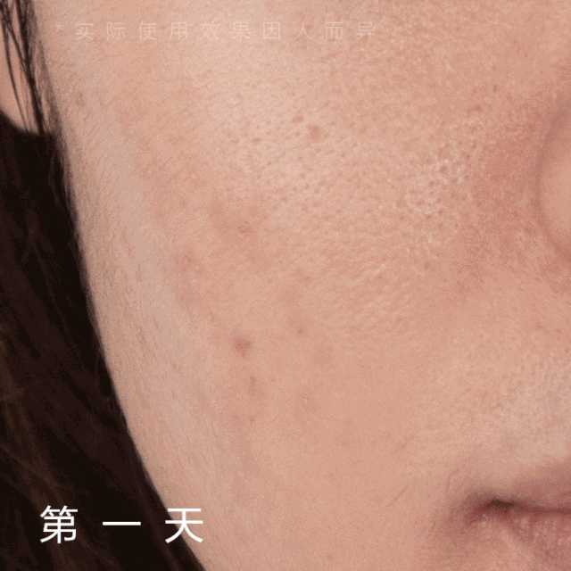几十块就能收毛孔!这支超好用的“磨皮原液”，连我的黑头也治好