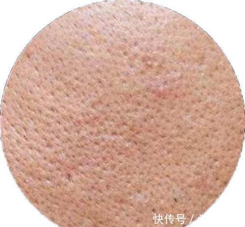  『可柏迷迭』毛孔粗大是衰老的开始，3个植物妙招收缩毛孔，让你瞬间年轻10岁