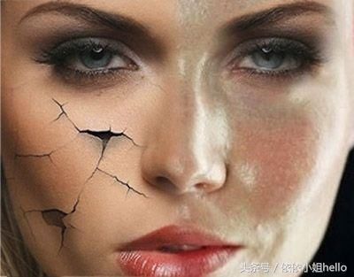 为什么你的黑头越去越多？怎么样去黑头才是正确的呢？