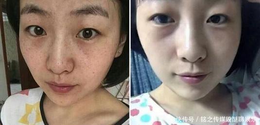 「 皮肤」坚持一周淡斑除皱又嫩肤,皮肤变得白嫩有弹性,蜂蜜加它涂抹脸部