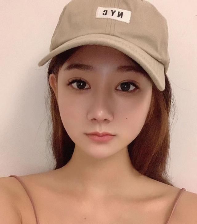  手术@隆鼻真的对颜值有影响吗？女孩术后真实记录，简直换了一个人！