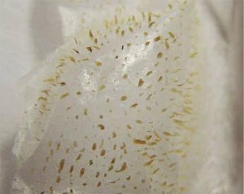 鼻子毛孔粗黑头多，可能是螨虫排泄物造成的，2招来自测有无螨虫