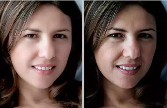 如果说你脸上有十万“螨虫大军”你信吗？