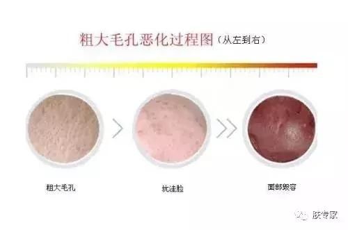 骆杉:面部衰老?初老症的5大现象你中了几条?