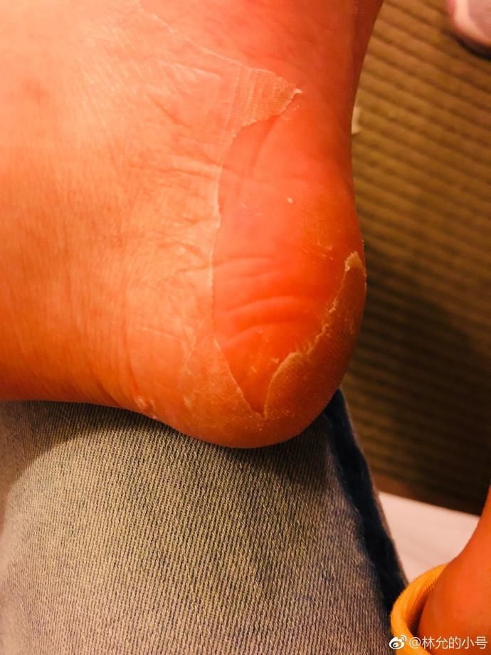 林允回应撕脚皮说了这样的话，这次连粉丝也救不了她