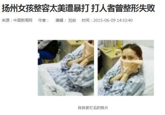 女孩整容太美遭暴打 杨颖杨幂会不会遭追杀呢?