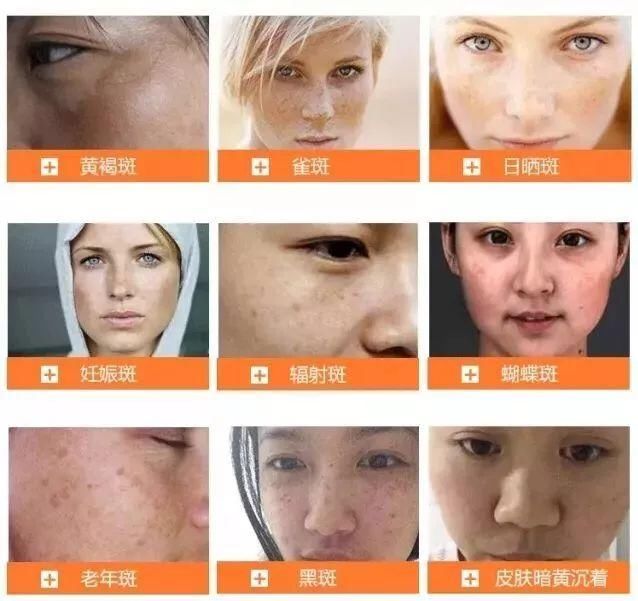 每个女人都希望青春永驻