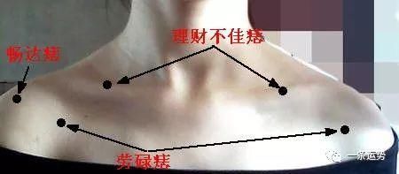 痣相解析 左肩有痣代表什么 不同位置的痣点代表的含义不同 生活 云南龙网