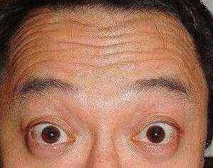 睡前脸上擦一点,一周一次皮肤白里透红,斑点皱纹到六十都见不到