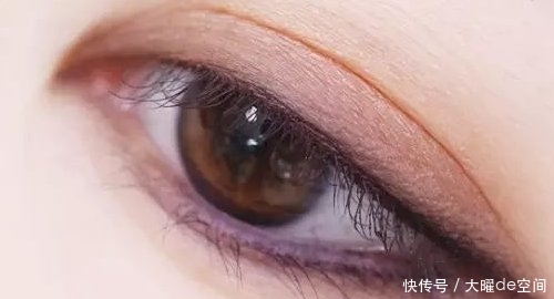 「双眼皮」韩式双眼皮手术价格贵不贵呢