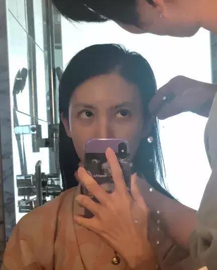 血管型黑眼圈@当妈后黑眼圈明显加重?黑眼圈不是病,挂在眼睛上真“要命”