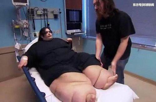 体重540斤的胖妞，成功减肥360斤，朋友们都快认不出她了！