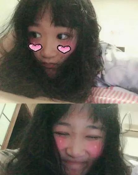 双眼皮一个月亲身经历，割对了双眼皮真的可以改变人生!