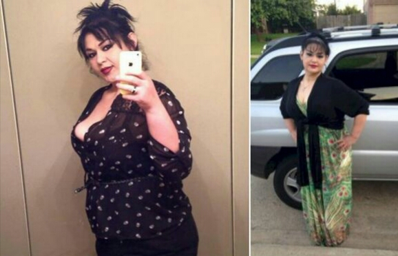 女子体重达900斤！减肥后这样美