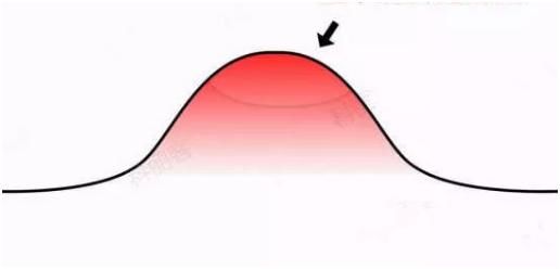 有了“痘”不知道该怎么办？