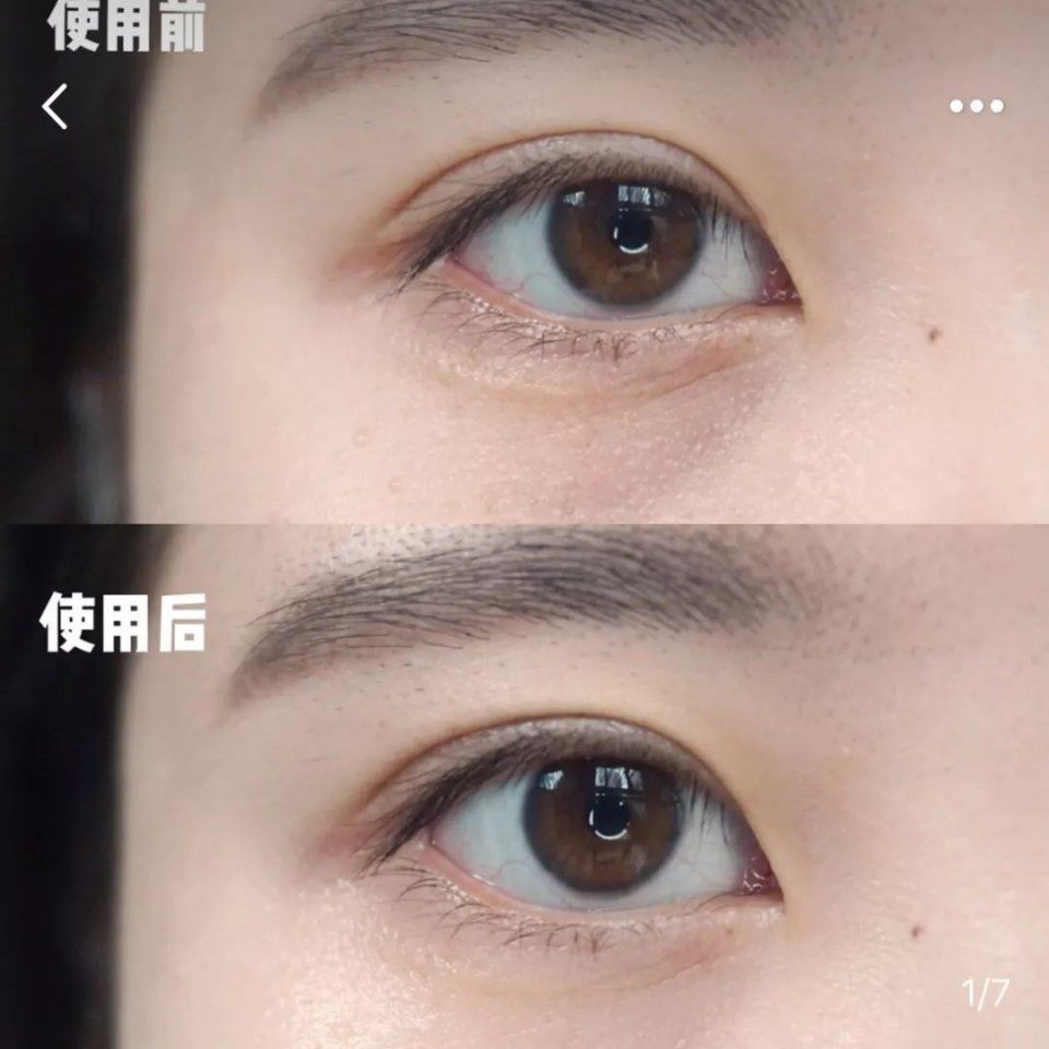 用了10多款眼霜，这支能去细纹还不长脂肪粒，我一次囤10支!