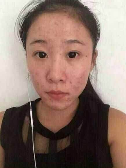 比开塞露强十倍，牙膏拌上它，一个月祛斑祛皱，脸蛋变白皙光滑