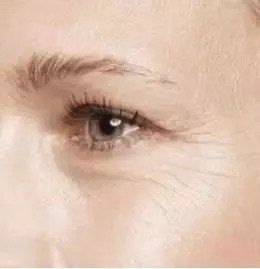 让你瞬间显老10岁的皱纹，你注意到了吗?