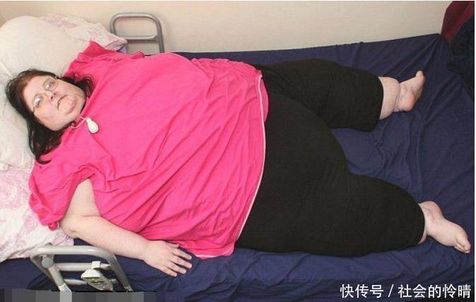 国外女子因饮食不规律肥胖猝死,网友:这就是传