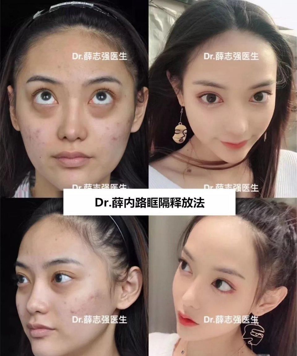  『后12小时内』假期术后注意事项大全！