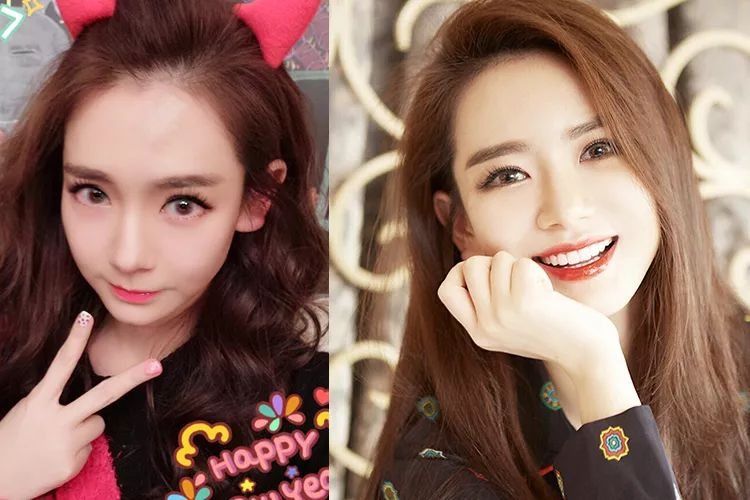 惊!戚薇开眼角了?还是无痛的