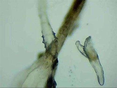 脸上突然冒很多痘?多数是“螨虫排泄物”在毛孔爆发，3方法除净