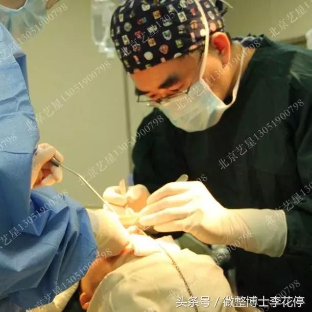 实锤：国民闺女，整容了？