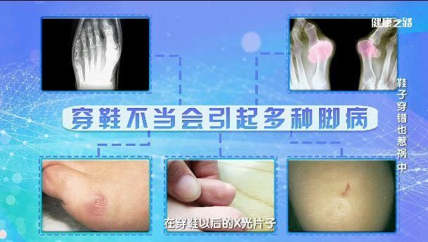 鞋子好不好，脚真的知道!买鞋前记住这3点!