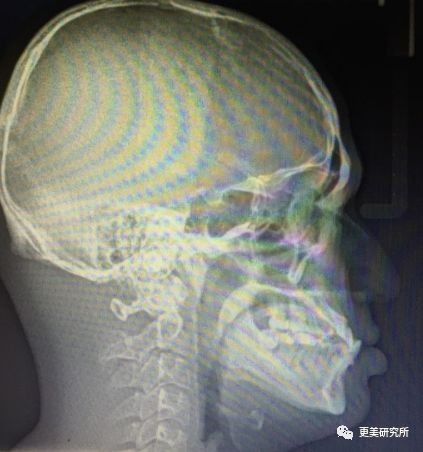 “整牙到底能不能瘦脸”终于有了权威结论，杨幂竟是被冤枉的?