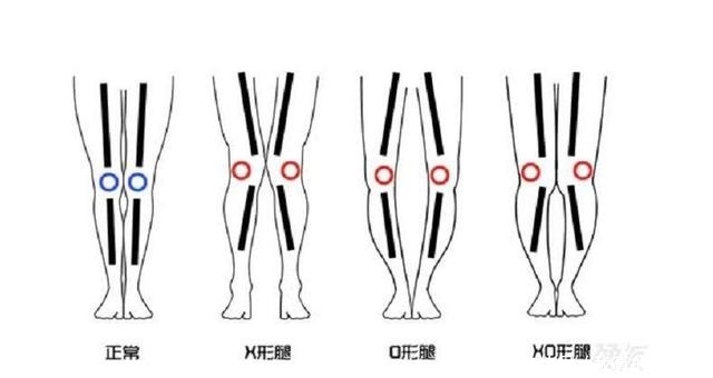  合适@如何挑选鞋子才会更合适？这些方法告诉你