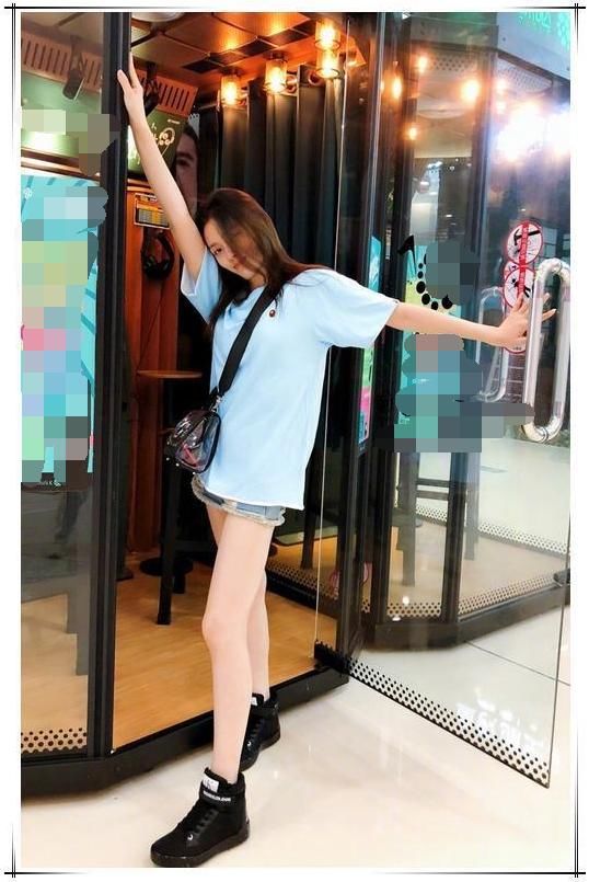 林允太奇葩了，满腿都是小疙瘩还敢穿短裤，网友:到底怎么想的?