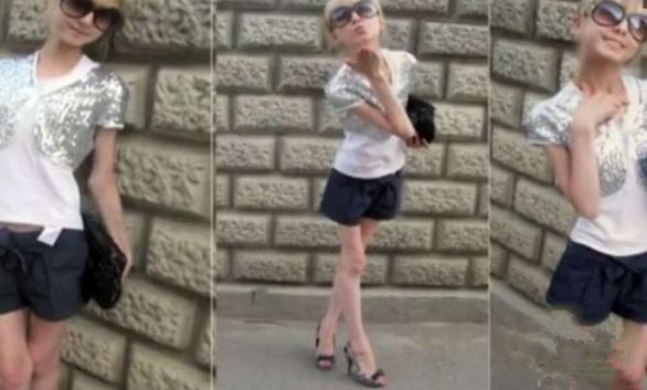 女孩为了拥有完美身材，整天靠喝水少吃饭，结果变成这副模样！