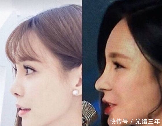 鼻子■鞠婧祎这是第几次do鼻子了?还没消肿就走红毯意外艳压全场!
