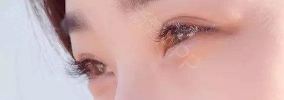 双眼皮“黄金不败宽度”来了!某璐要是早看到也不至于割完眼皮又