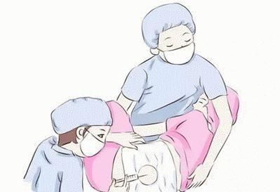  「医生」无痛分娩，你都了解吗？快看看经历的产妇怎么说！