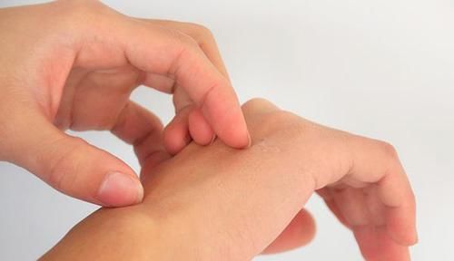  『小妙』春天皮肤总是容易干燥？送你补水小妙招，让肌肤喝饱水逐渐变水润